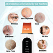 Ultrasonic Skin Perfecting Tool