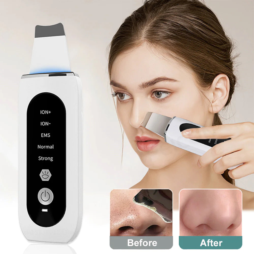 Ultrasonic Skin Perfecting Tool