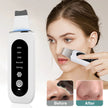 Ultrasonic Skin Perfecting Tool